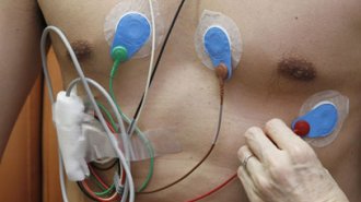 若い人にも起こる心臓突然死 心電図検査で予測できる？