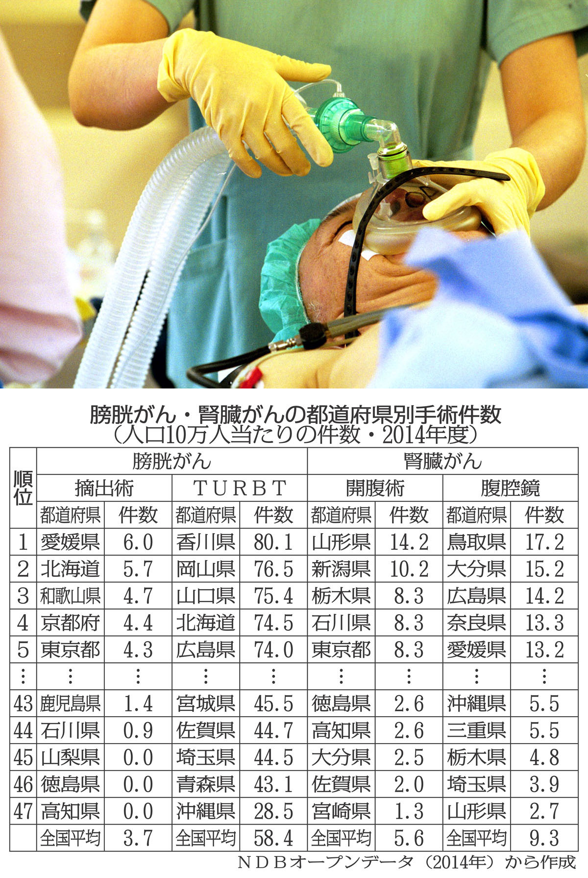 膀胱がんと腎臓がんの都道府県別手術件数