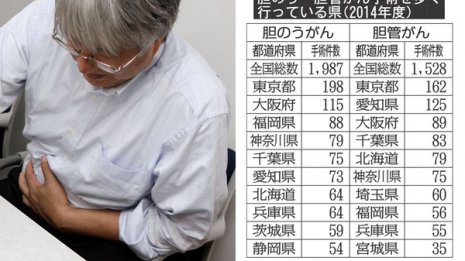 胆のう・胆管がん手術 東京は総手術数の１割を担う