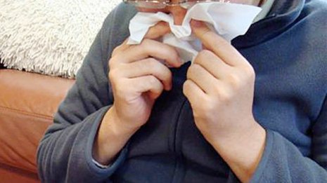 発作のコントロールにはアレルギー性鼻炎治療も不可欠