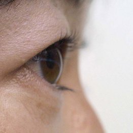 緑内障の目薬をまつ毛美容液として使用するのはリスク大