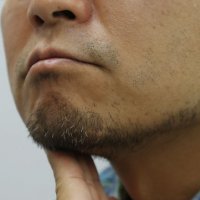 リスクが16分の1に低下「ひげ」が皮膚がんを予防する