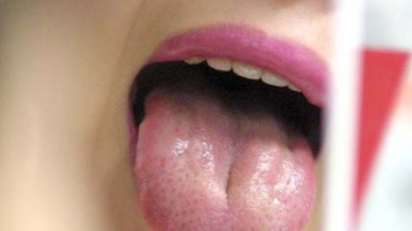 水分摂取量は適正？ 「舌」の状態を見れば体の異常がわかる