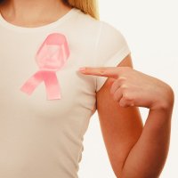 乳がん<2>ステージ区分と重視されつつある5つのサブタイプ