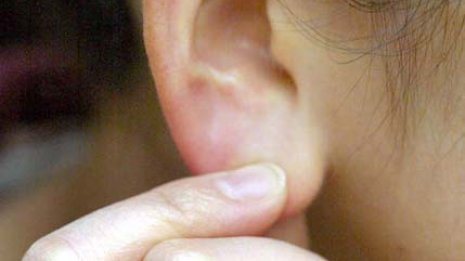 難聴は認知症の危険因子 補聴器は早めの装着で慣れること