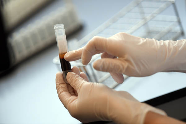 新型コロナウイルス感染した患者の血液にできた抗体を調べる大学病院の関係者（ドイツ・エアランゲン市）／