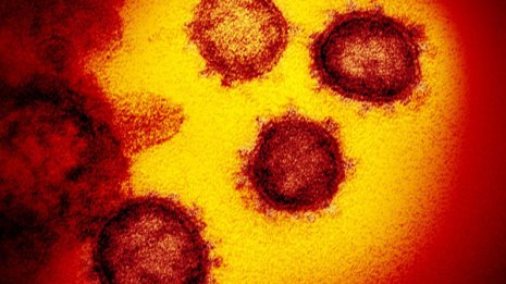<10>昆虫ウイルスが“証明”した自然免疫の強い抗ウイルス力
