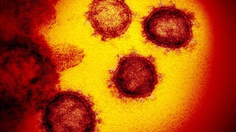 新型コロナウイルスに対する心理的影響は性格による？