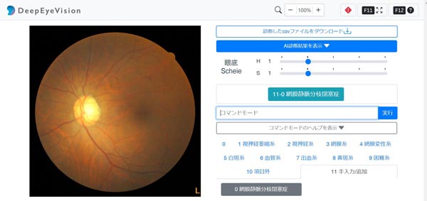 「眼科向け画像AI診断支援サービス」／