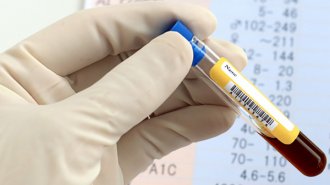 血液型で異なる新型コロナウイルス感染症の重症化リスク 欧米の一流医学誌が報告