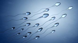 男性不妊の精子判別補助AIの実力 感度99％、陽性適中率92％