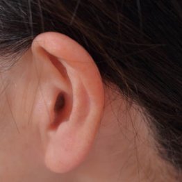 「補聴器の落とし物は補聴器販売店へ」SNSのつぶやきが話題に
