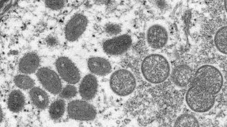 28カ国で同時多発的な感染を確認…「サル痘」世界的流行への違和感