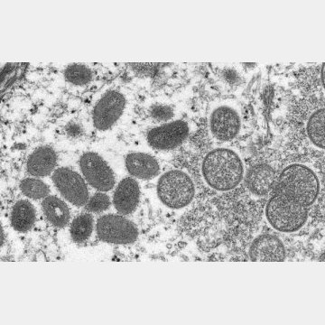 サル痘ウイルスの顕微鏡写真（CDC提供・共同）