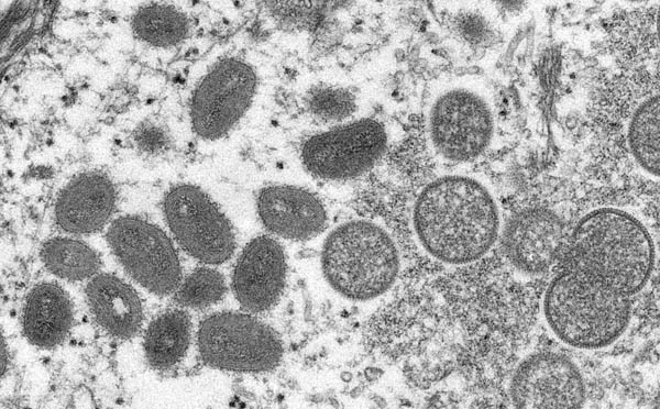 サル痘ウイルス（Ｃ）CDC提供・共同