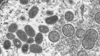 【サル痘】18人感染確認…日本では一般的に広く使える治療薬はない