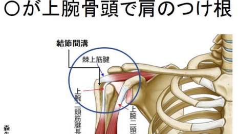 肩の痛みが続く「上腕二頭筋腱損傷」の診断は非常に困難