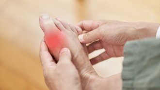 痛風かと思ったら…足の親指の強い痛みは「強剛母趾」かもしれない