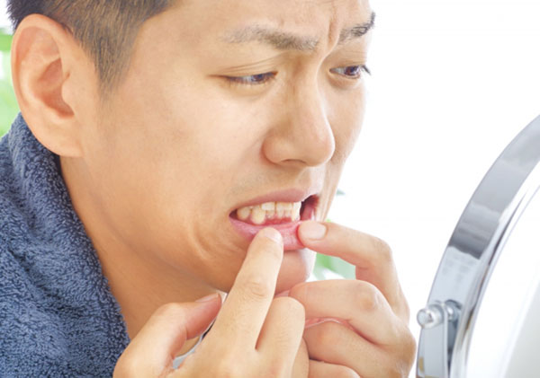 歯周病とさまざまな疾患との関連が指摘されている