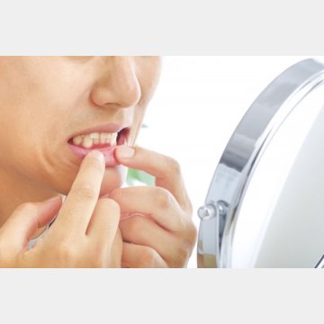 白い歯を維持している人は自己管理ができていて信頼できるイメージが