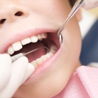 歴史的な円安、相次ぐ値上げ…生活苦は「歯」の健康へどう影響するのか？