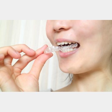 マウスピースは歯の摩耗や欠けるのを防ぐために効果的